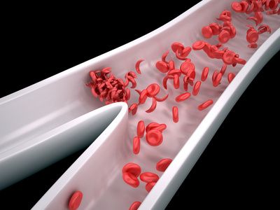 Fotolia_69871819_XS-min